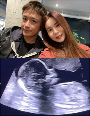 チン・テヒョン「妻パク・シウンを信じて行ってみよう」 妊娠5カ月の超音波写真を公開