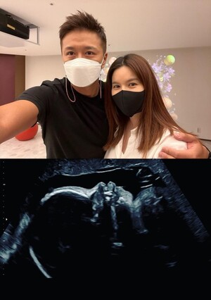 チン・テヒョン、「妊娠8か月」妻パク・シウンに感謝…赤ちゃんくっきりエコー写真公開
