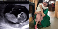 キム・ミリョが第2子妊娠、エコー写真公開