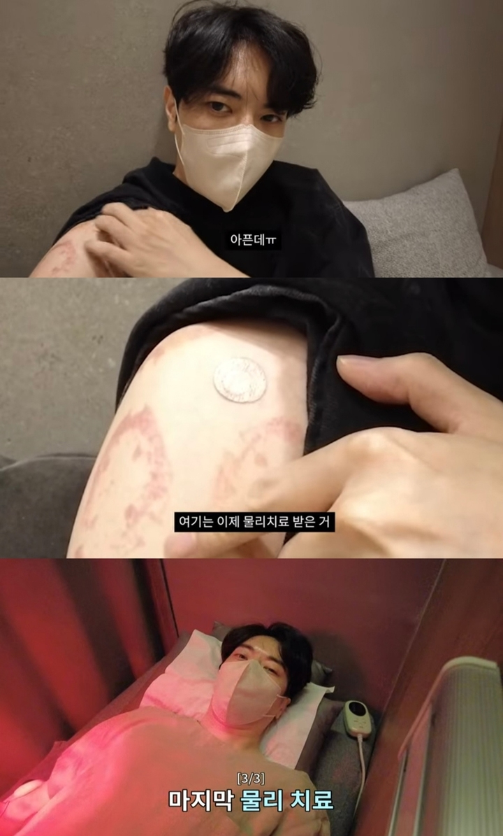 『外見至上主義』で人気のウェブ漫画家T.Jun「肩のじん帯をかなり損傷した」