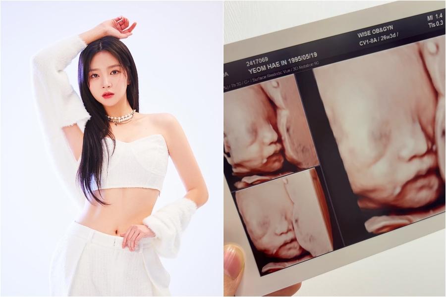 第1子出産から4カ月で第2子妊娠のLABOUMヘイン、胎児のエコー写真公開