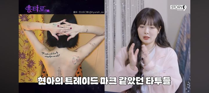 ヒョナ　母の願いで全身タトゥー消し始めて1年…「すごく痛いです」