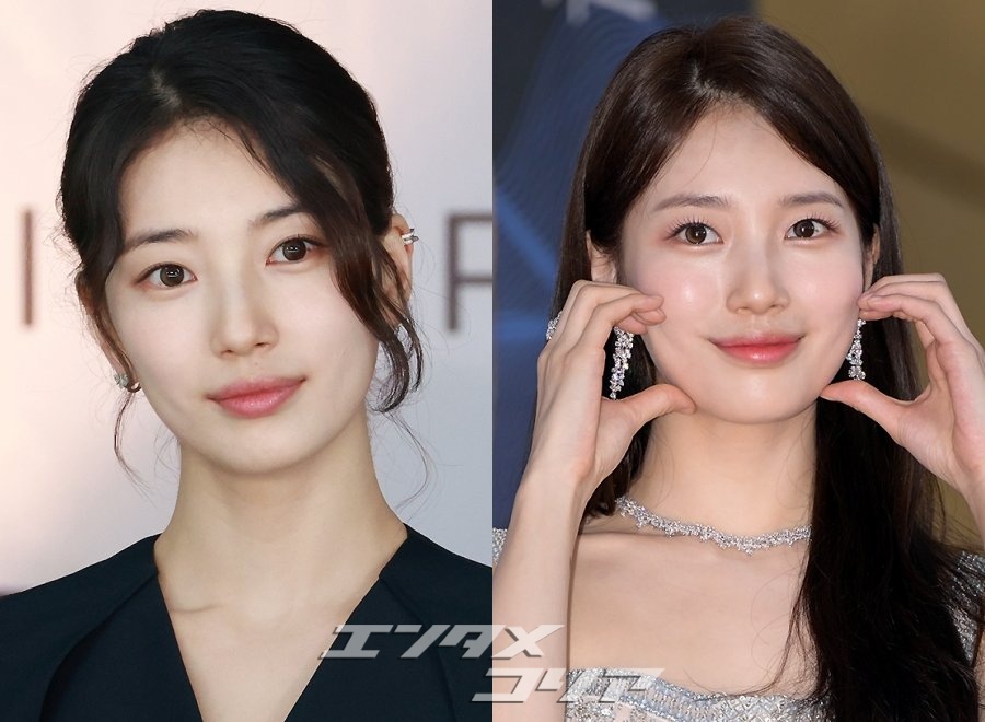 スジ「白目のほくろ、意外と気に入っていたけど除去した」