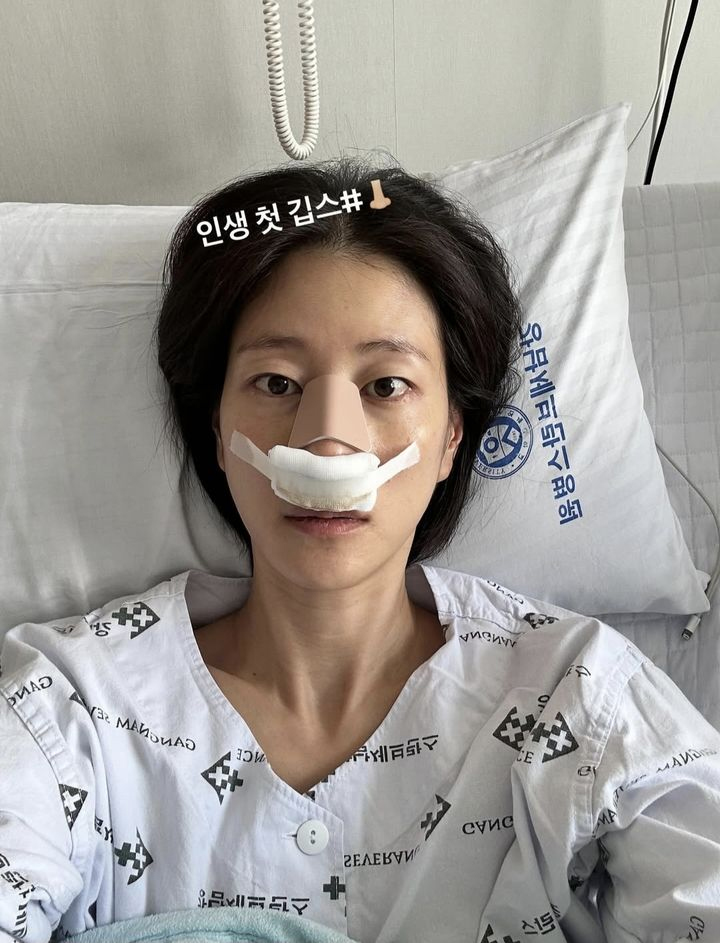 イ・ヒョニ、『ボールを蹴る彼女たち』の試合中に鼻を骨折　「人生初ギプス」