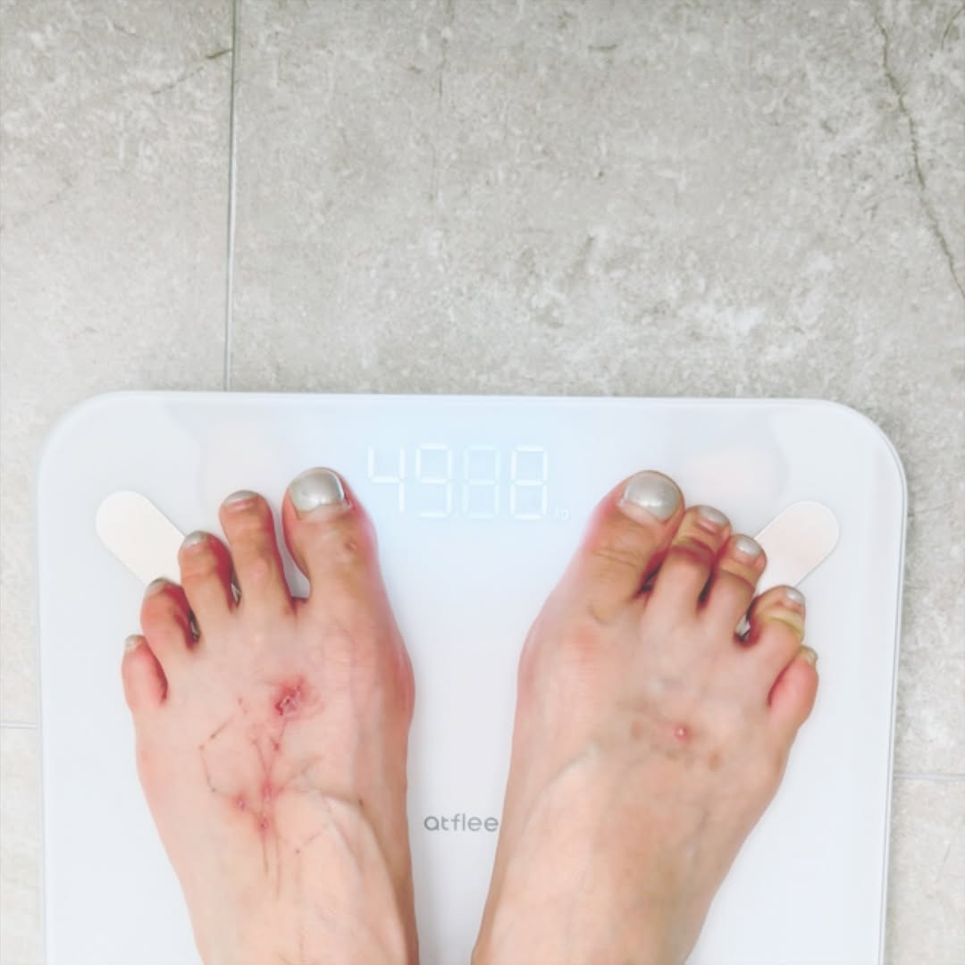 10キロ減量したヒョナ、夫ヨン・ジュンヒョンと甘いキス…シャープになったあごのライン