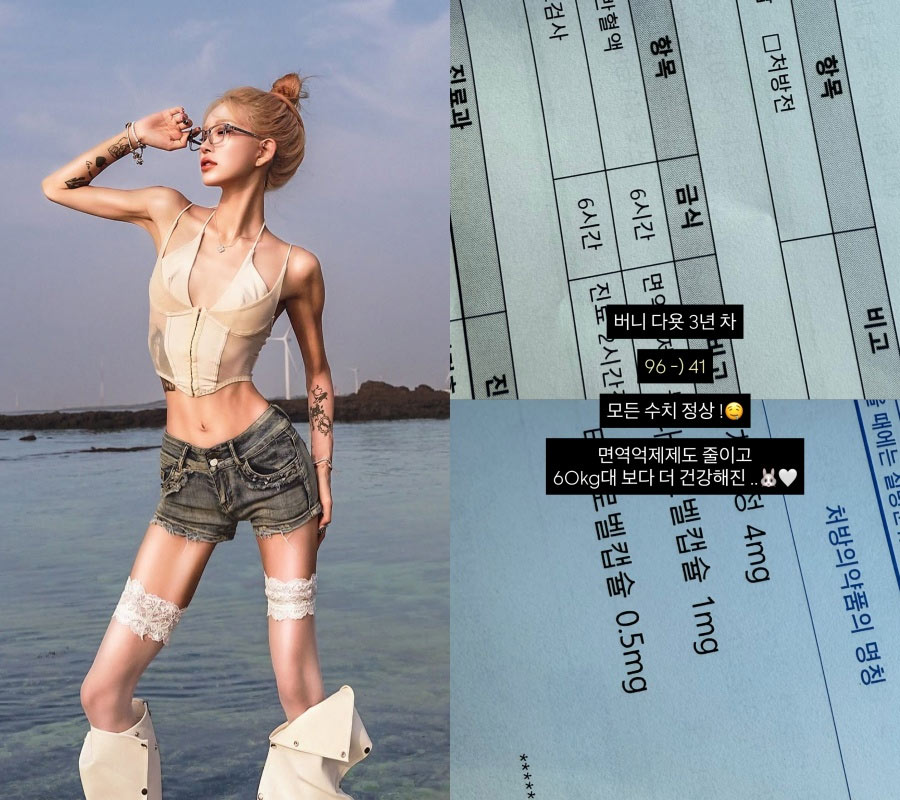 ダイエット3年目チェ・ジュニ、骨と皮な体重41キロの姿は心配だけど…「全ての数値は正常」