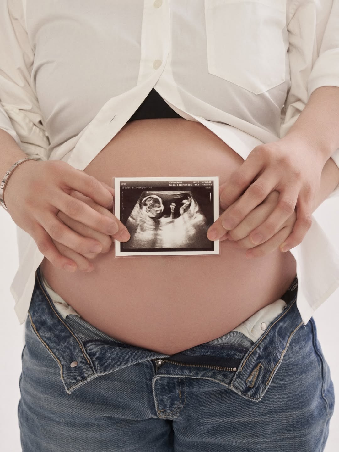 【フォト】ウン・ガウン＆パク・ヒョノ、愛あふれるマタニティフォト公開　「幸せだった」