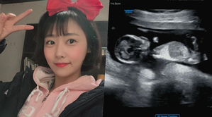 ユン・ダフンに孫娘…ナム・ギョンミン「妊娠」 おなかの中の娘の超音波写真公開