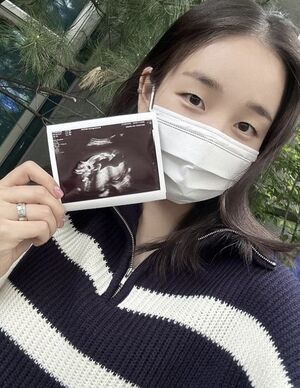 ペク・アヨン「妊娠5カ月…赤ちゃんは女の子」