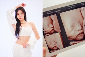 第1子出産から4カ月で第2子妊娠のLABOUMヘイン、胎児のエコー写真公開