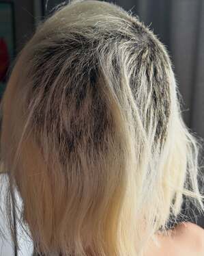 【フォト】DJ SODA、ひどく傷んだ髪の写真公開