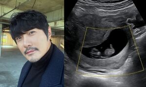 43歳KCMが三児のパパに…超音波写真公開