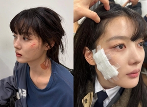 キム・ユジョン「血まみれ+ガーゼ、いったい何が」…『親愛なるX』オフショット公開